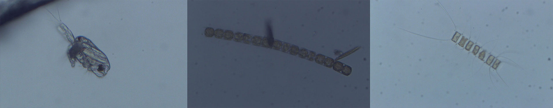 Tulalip Natural Resources Department image of microscopic organism