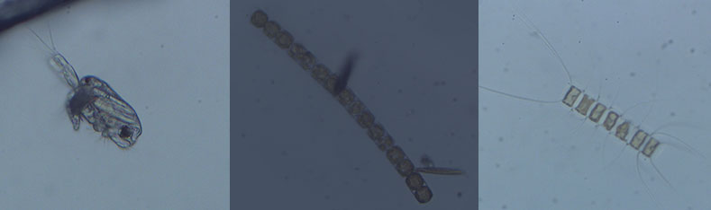 Tulalip Natural Resources Department image of microscopic organism